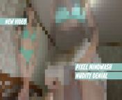 Loser nudity denial teaser from queer pixel