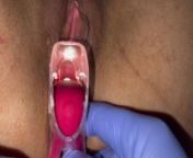 the gynecologist speculum examination brought me to orgasm fluid examination from www muthu selvi m l a sexvideo com